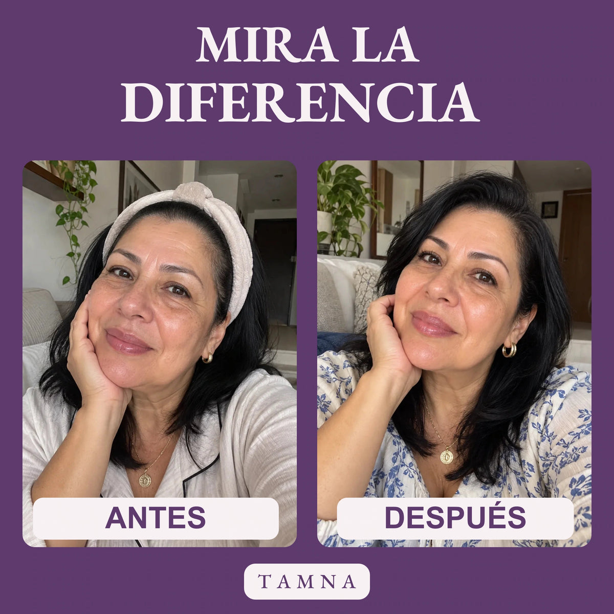 Mira la diferencia · Fotografías antes y después